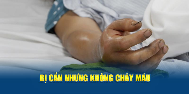 Bị cắn nhưng không chảy máu